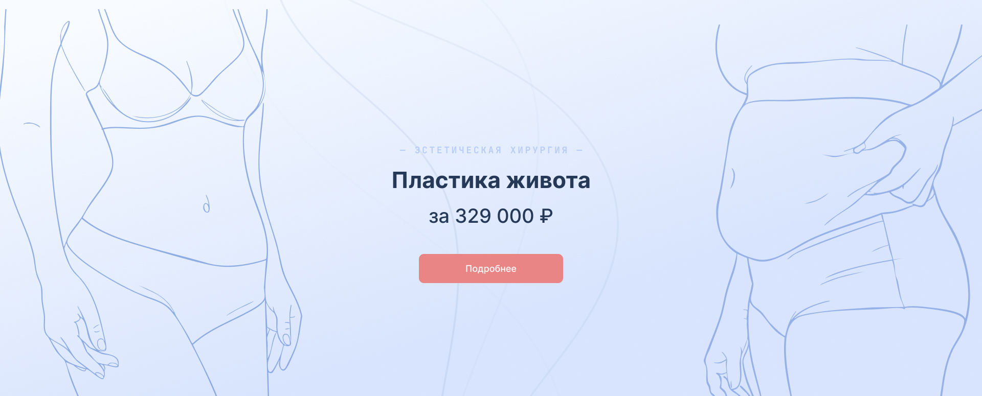 Абдоминопластика