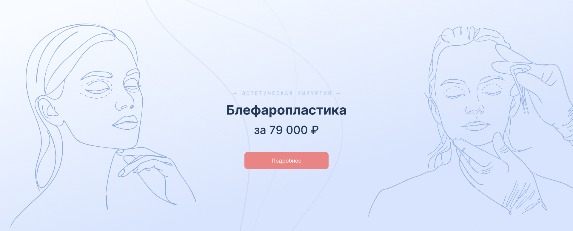 Блефаропластика